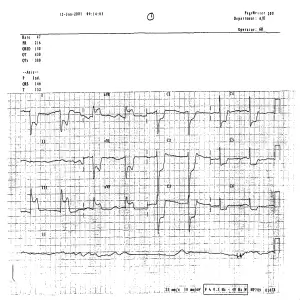 2001 ECG resolution 1